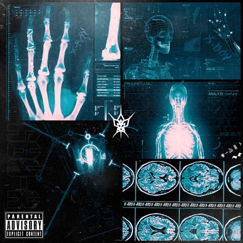 X-RAY
