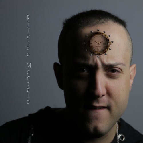 Ritardo mentale