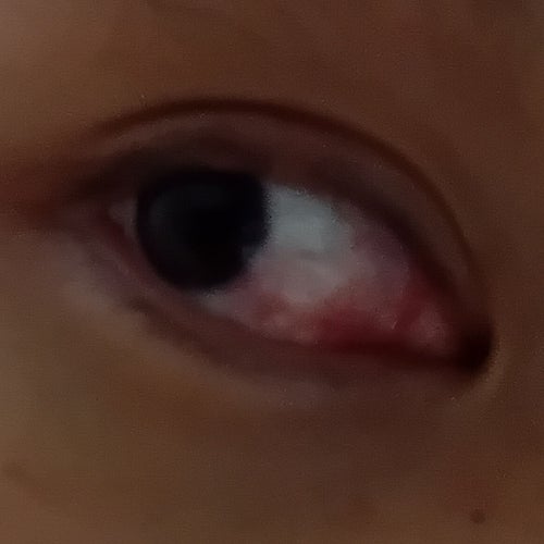 Mắt Díu (Extended Version)