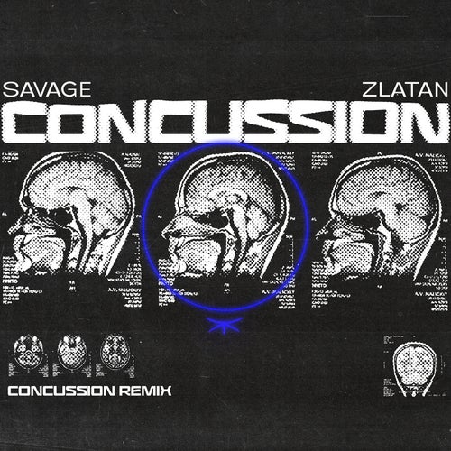 Concussion (Remix)