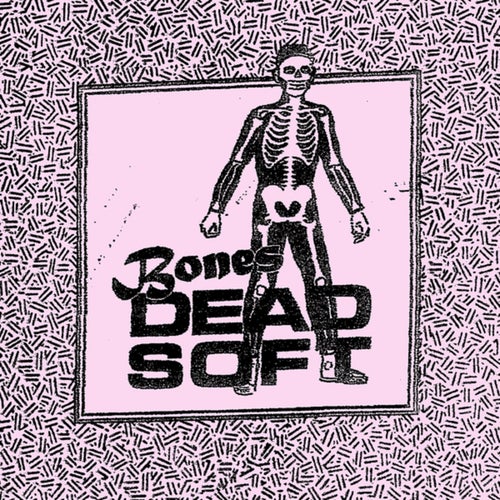 Bones