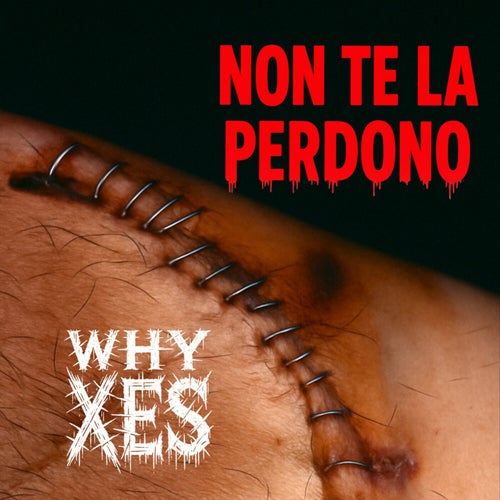 Non te la perdono
