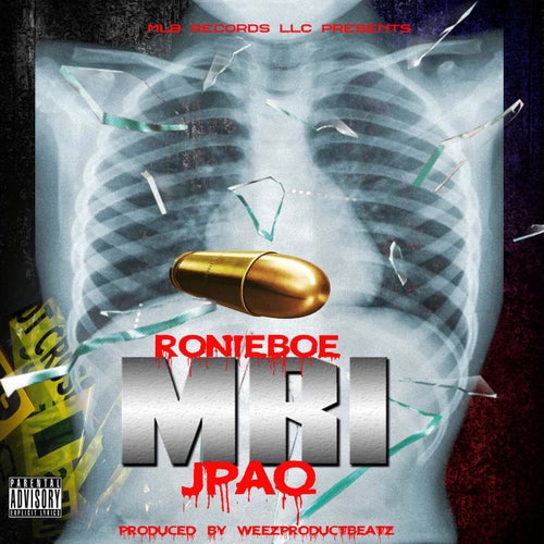 MRI (feat. JPaq)