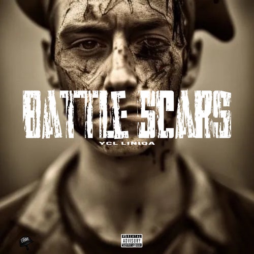 Battle Scars