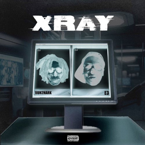 X-Ray