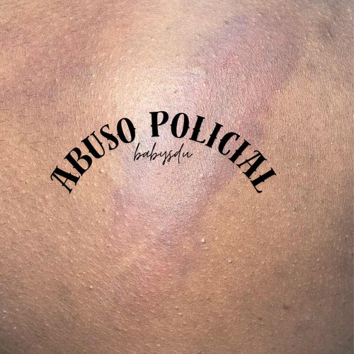 Abuso Policial