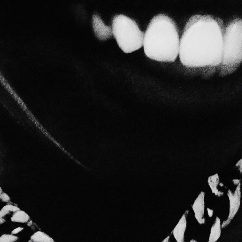 Static in my Teeth