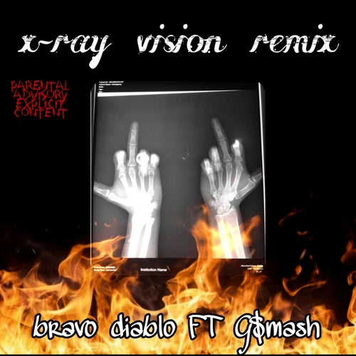 X-Ray Vision (Remix)