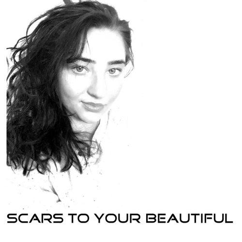 Scars to Your Beautiful