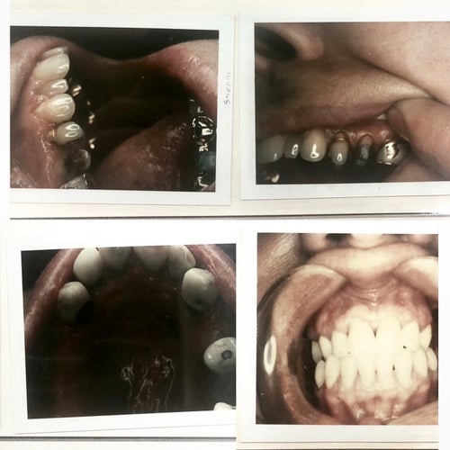 Taking Teeth: Volume 1 (Volume 1)