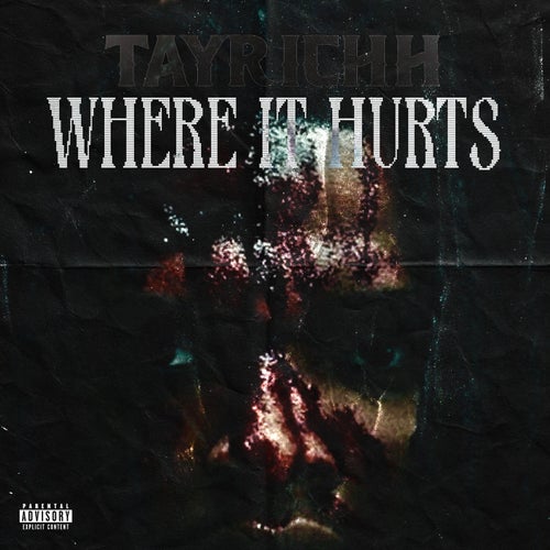 Where It Hurts