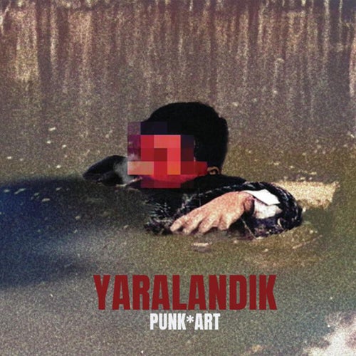 yaralandık