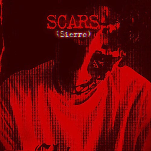 Scars