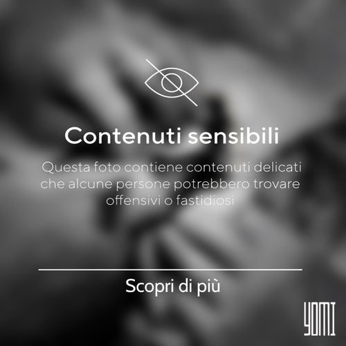 Cicatrici
